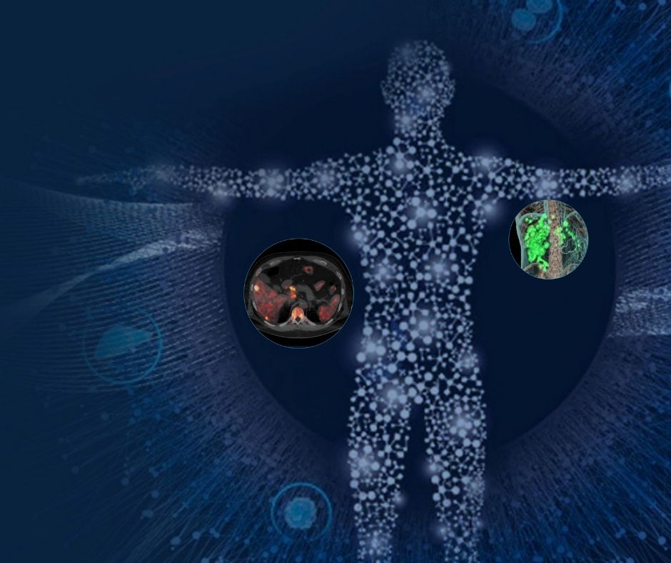 Theranostic = Therapy + Diagnosis