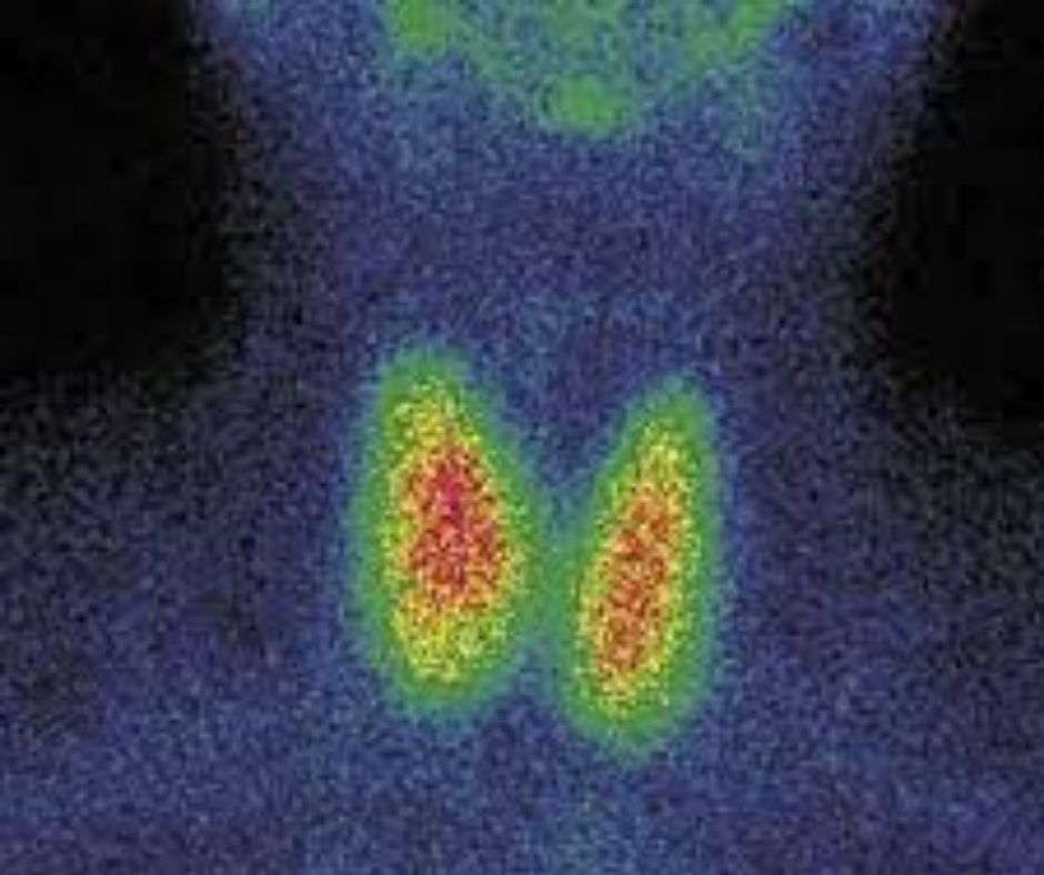 Thyroid Imaging and Therapy